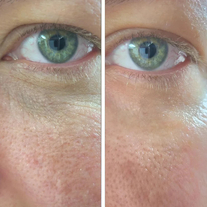 Volufiline Deep Collagen Power Serum