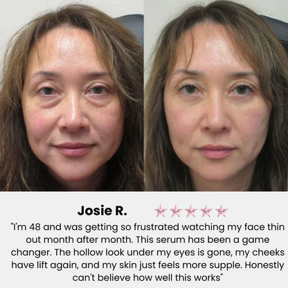 Volufiline Deep Collagen Power Serum