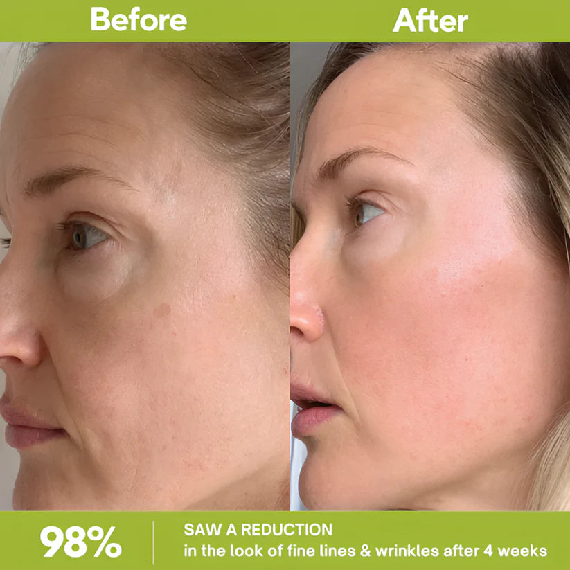 Retinal Shot Tightening Booster