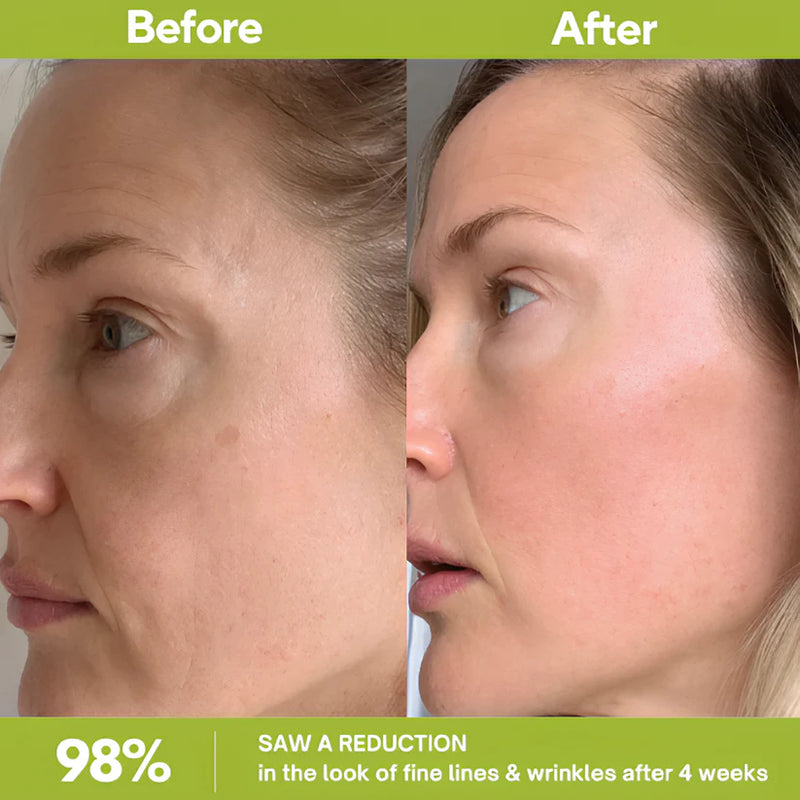 Retinal Shot Tightening Booster